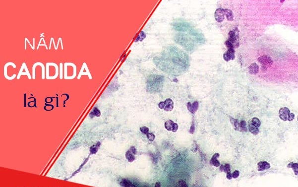 Nấm Candida là gì? Nấm Candida có nguy hiểm không?